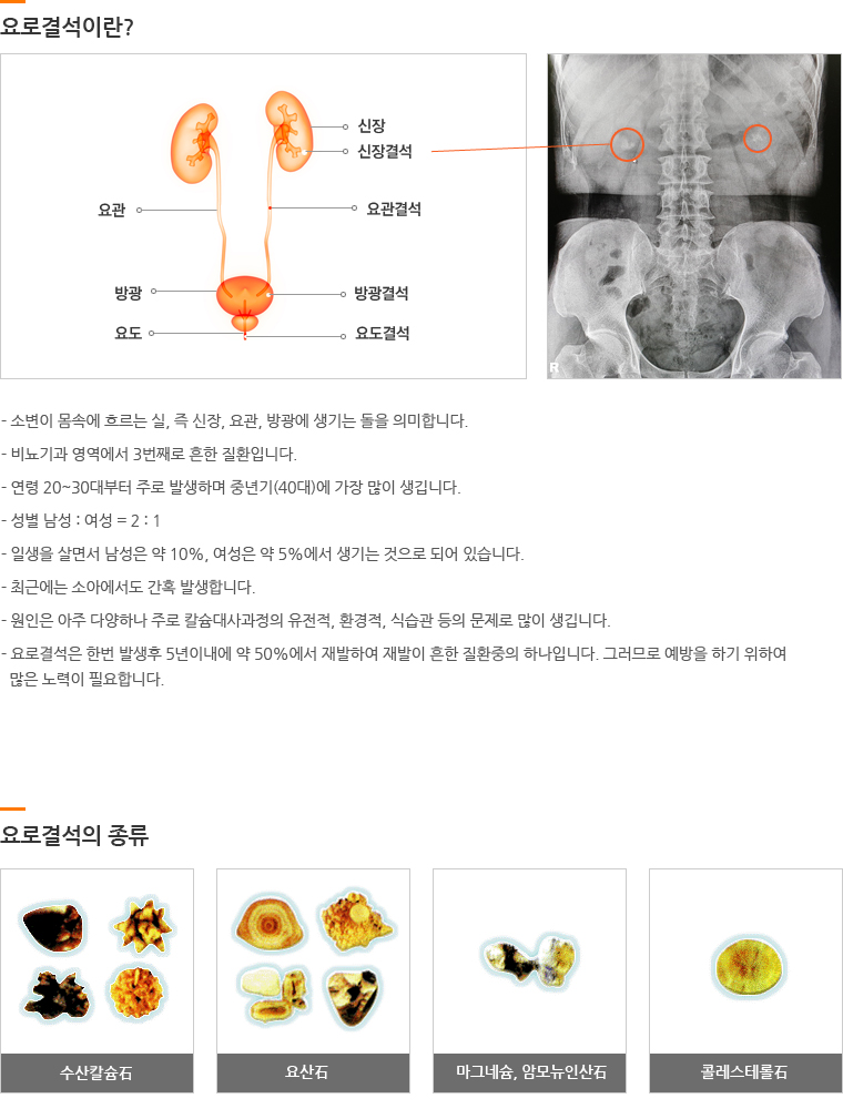 대치엘